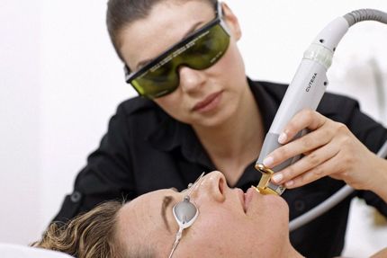 2-laser-treatment